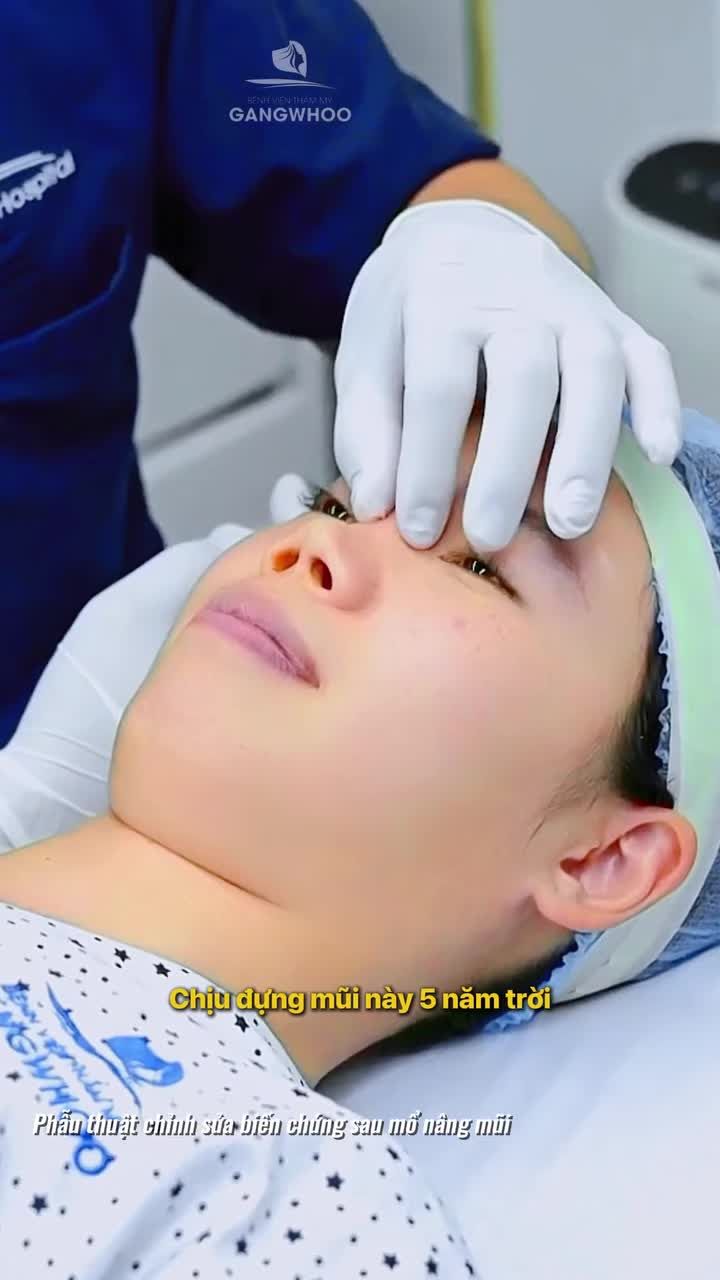 5 năm mặc cảm vì chiếc mũi biến dạng và kết quả sau khi sửa mũi lại tại Gangwhoo