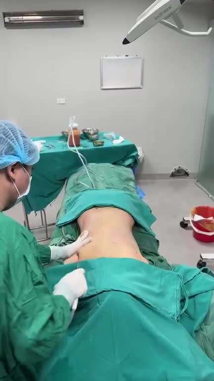 Hút sửa mỡ lưng và hông-eo !