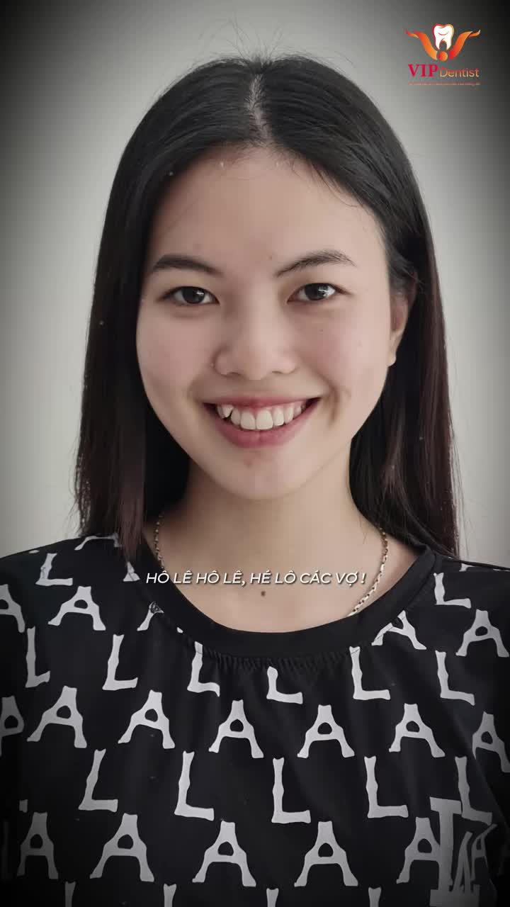 Cùng nhìn lại hành trình thay đổi của bạn Vương Thanh Thảo để thấy sự kỳ diệu của niềng răng nha!