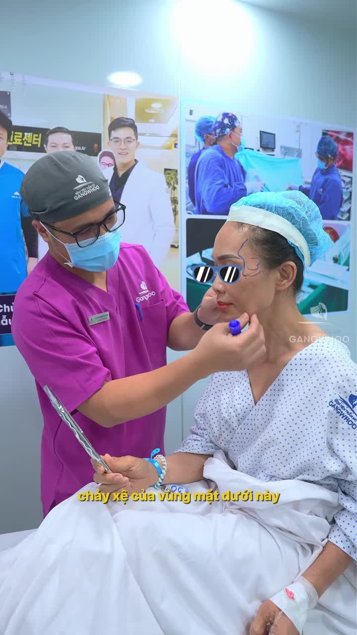 Cùng Bác sĩ thăm khám phân tích đánh giá tình trạng lão hóa trước thực hiện dịch vụ căng da mặt kết hợp midface