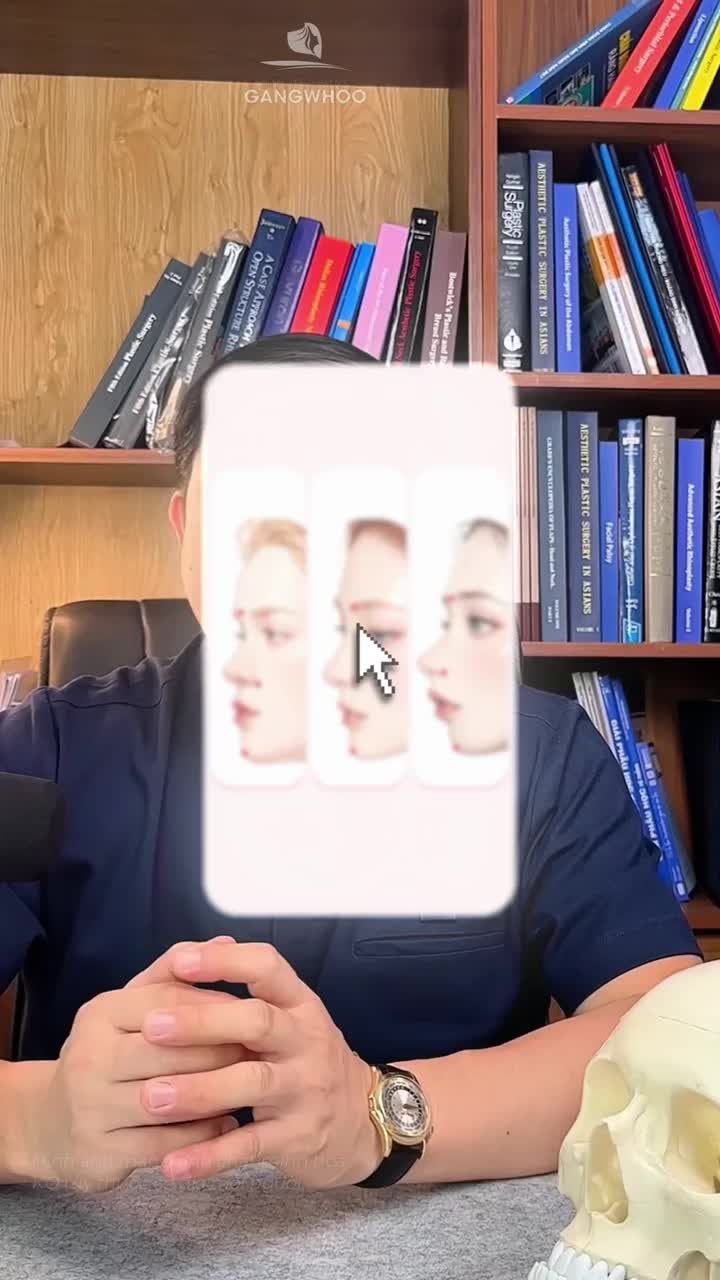 Tại sao người khác chụp hình ăn ảnh còn mình lại không? Cùng bác sĩ tìm hiểu để đưa ra những giải pháp làm đẹp an toàn giúp gương mặt hài hòa tự nhiên hơn nhé!