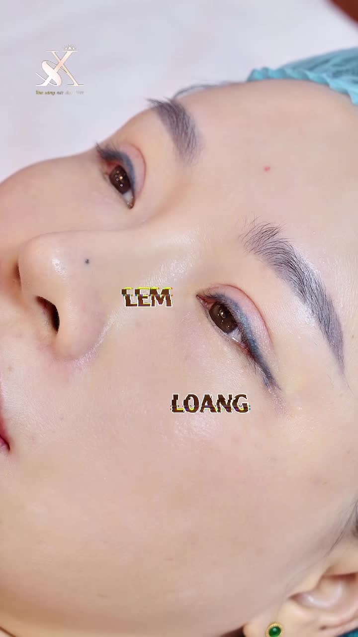 LOẠI BỎ MỰC XĂM MÍ - MẮT ĐẸP HẾT Ý 