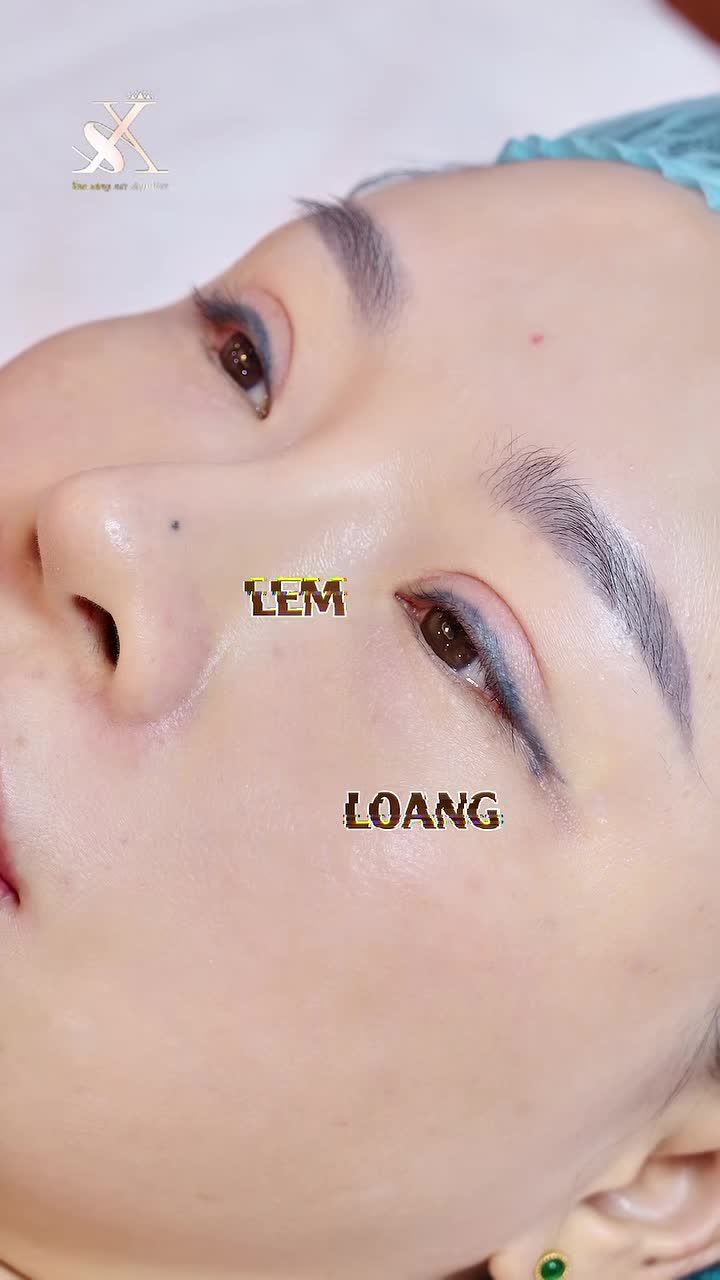 LOẠI BỎ MỰC XĂM MÍ - MẮT ĐẸP HẾT Ý 
