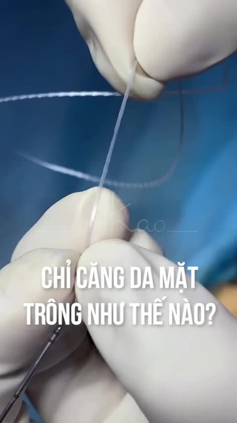 BẠN CÓ BIẾT CHỈ CĂNG DA MẶT TRÔNG NHƯ THẾ NÀO KHÔNG?