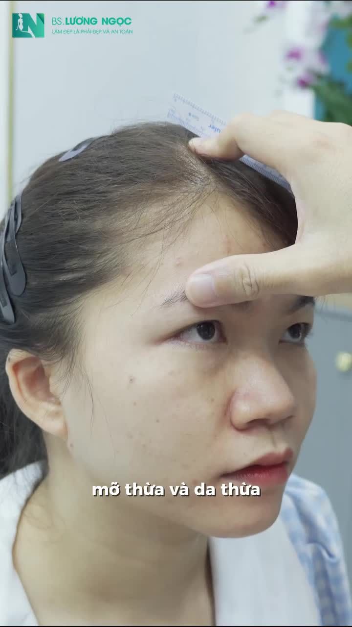 Dõi theo hành trình tìm lại đôi mắt rõ nét hơn và gương mặt tươi tắn