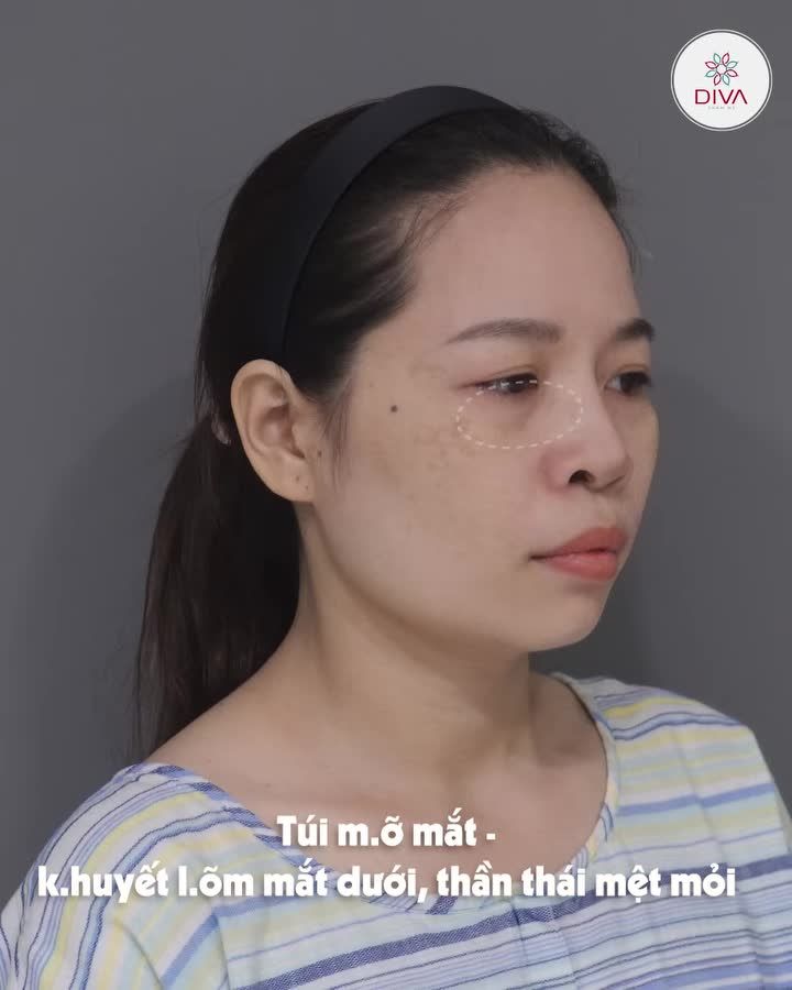 PHÂN TÍCH KẾT QUẢ SAU 1,5 THÁNG TM - KHUÔN MẶT ĐÃ THAY ĐỔI NHƯ THẾ NÀO?