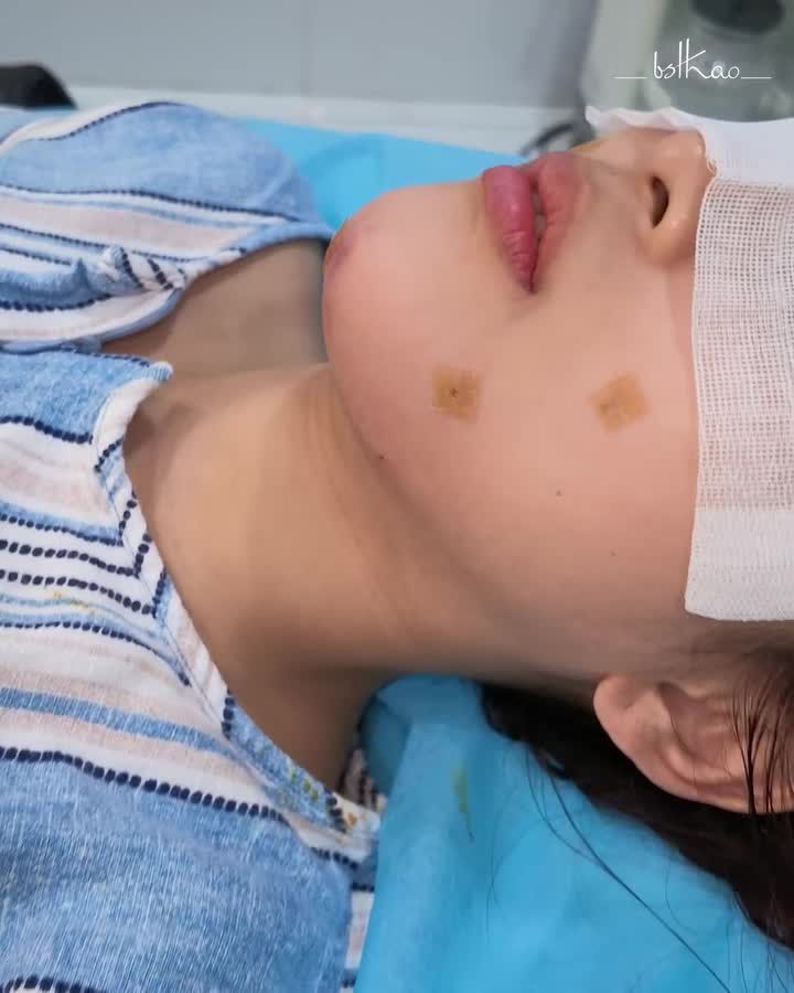 TẠI SAO VÙNG CẰM CÓ ĐỘ NHÔ TỐT THÌ SẼ CẢI THIỆN ĐƯỢC TÌNH TRẠNG HÔ MIỆNG?