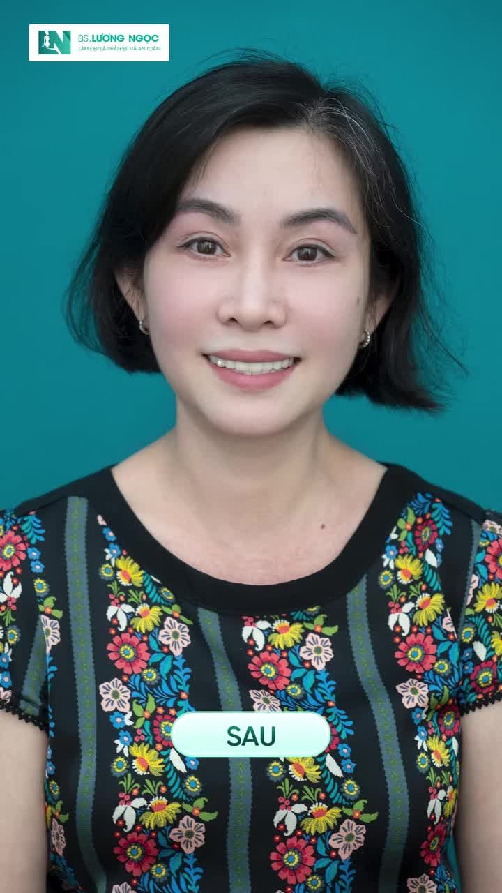 Combo Trẻ Hóa Mọi Góc Nhìn