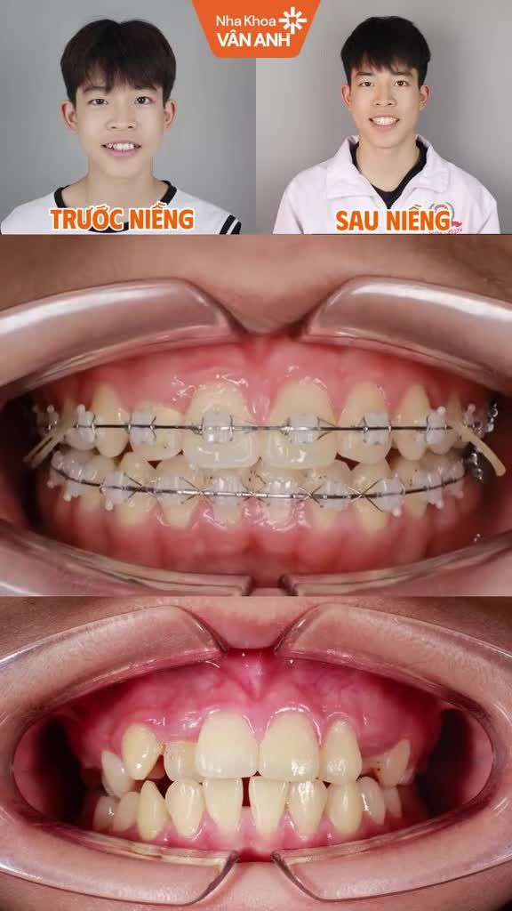 Điều chỉnh lại gương mặt thành 1 phiên bản hoàn hảo hơn