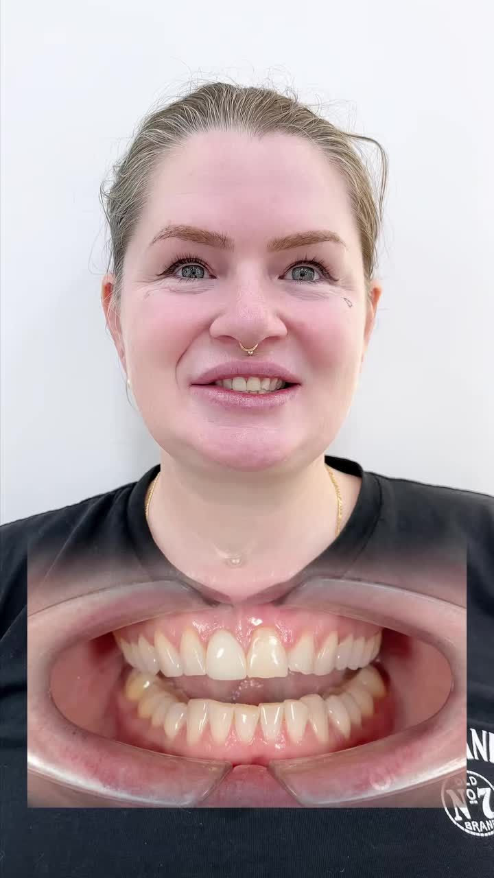 Mỗi nụ cười tại Win Smile đều mang theo một câu chuyện riêng, và câu chuyện của Alicia - vị khách đến từ nước Úc - bắt đầu từ một lời giới thiệu đầy tin tưởng của người bạn đã từng làm răng tại Win Smile trước đây