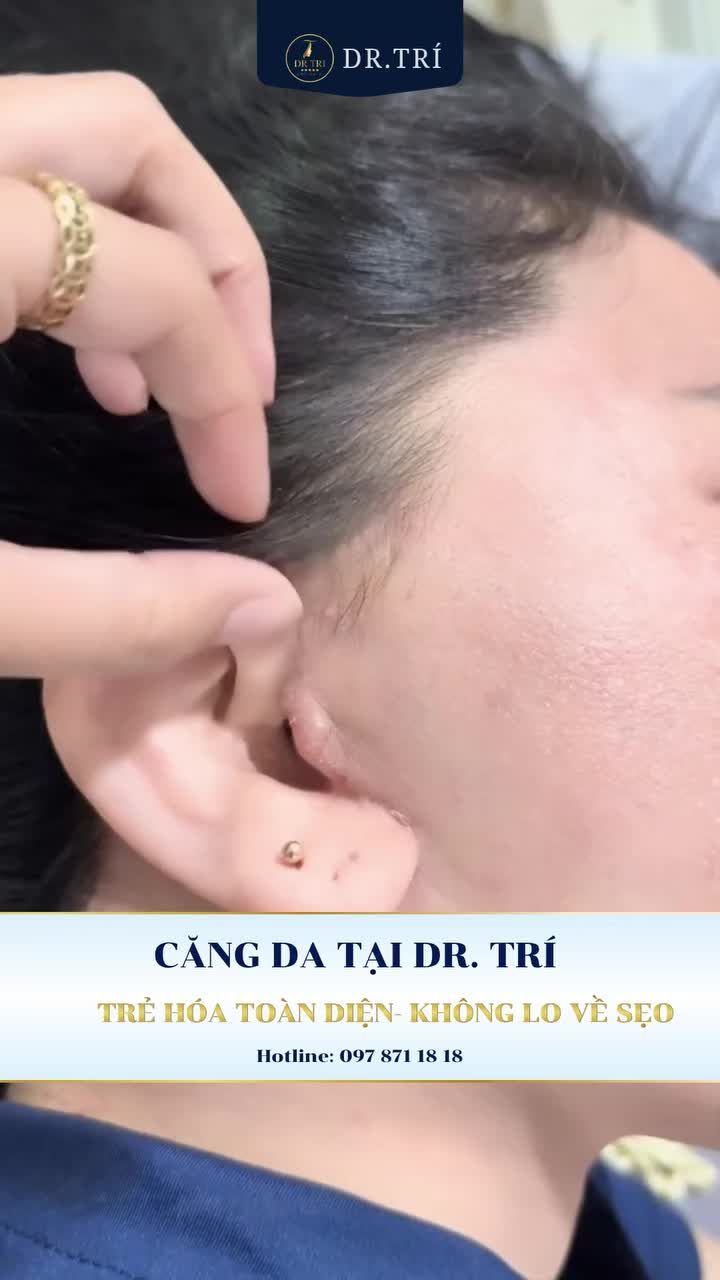 1 LẦN THỰC HIỆN - LẤY LẠI 10 NĂM THANH XUÂN!