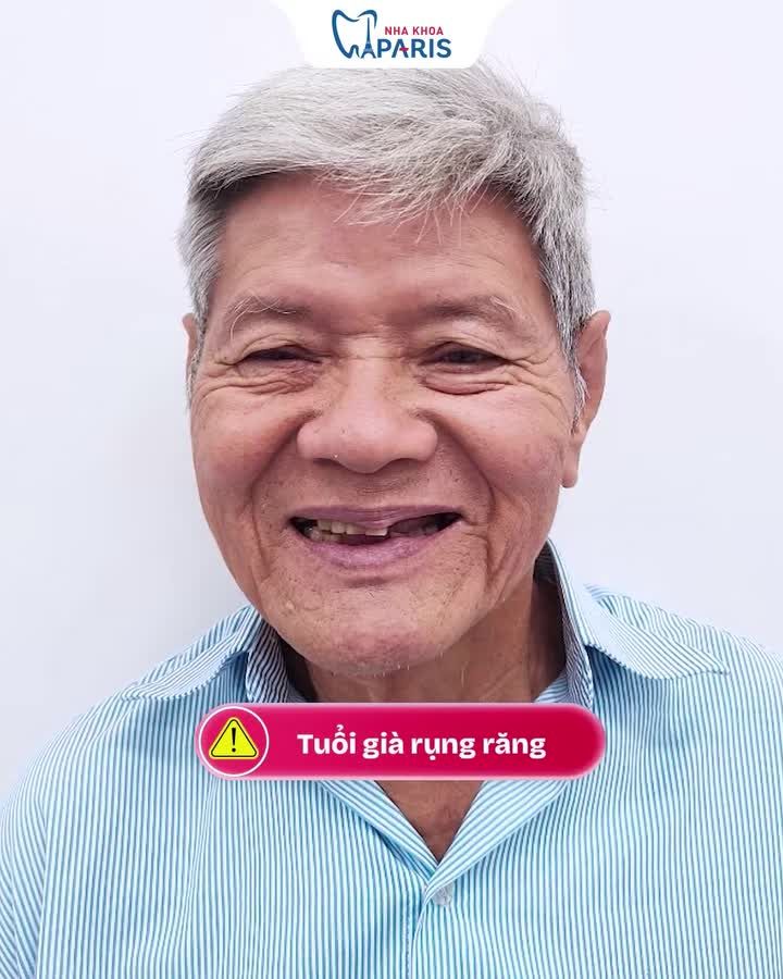 TRỒNG RĂNG IMPLANT - GIẢI PHÁP KHÔI PHỤC ĂN NHAI BỀN ĐẸP TRỌN ĐỜI!