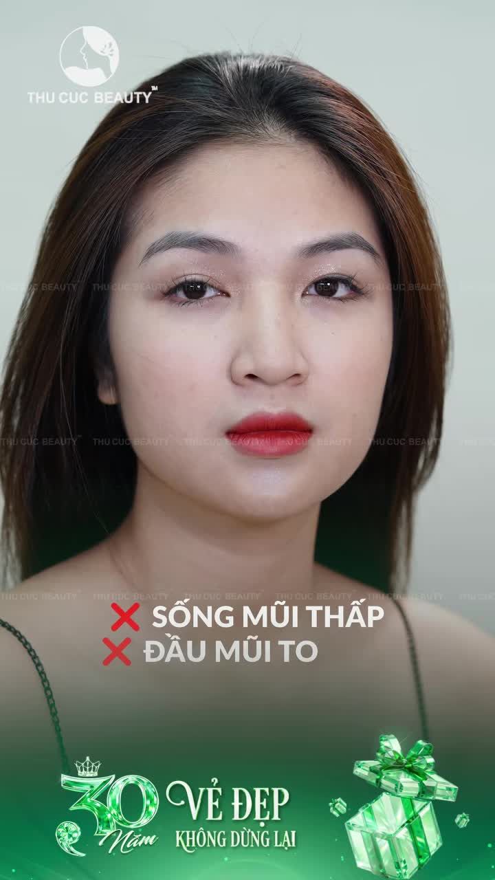ĐẠI TIỆC SINH NHẬT 30 NĂM: NÂNG MŨI SANG – GIÁ CỰC HỜI