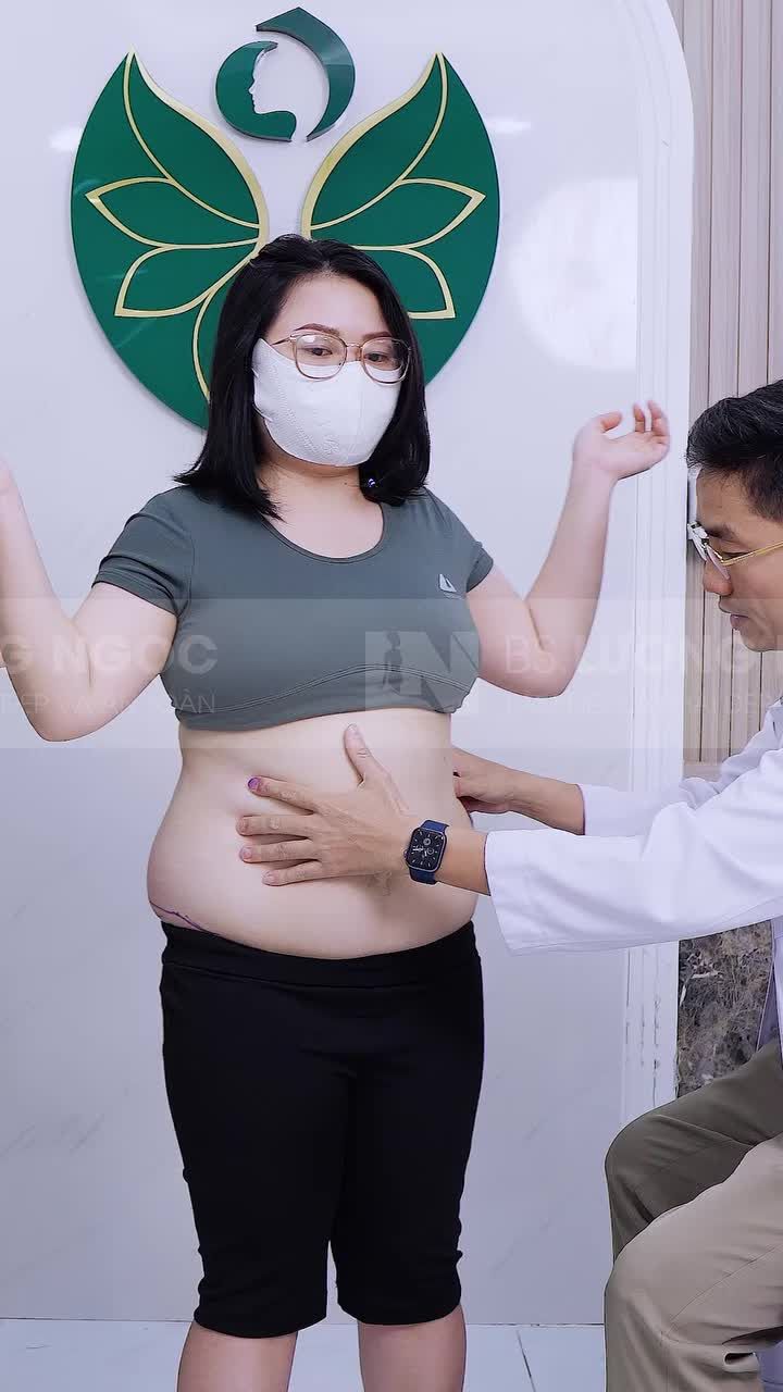 Với mong muốn: vòng bụng nhỏ đi 15 cm. Liệu kết quả sẽ thế nào?