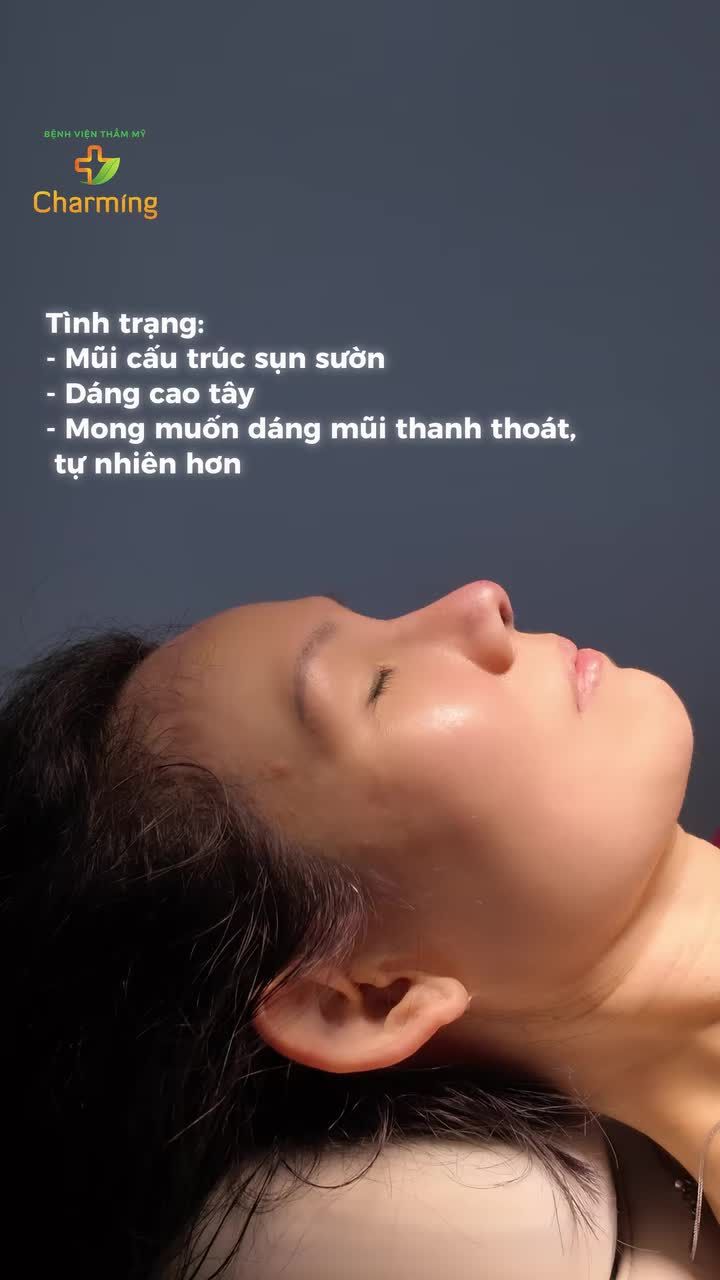 "Chiếc mũi bền vững" - 11 năm sau vẫn đẹp, chỉ cần tinh chỉnh để phù hợp hơn với hiện tại.