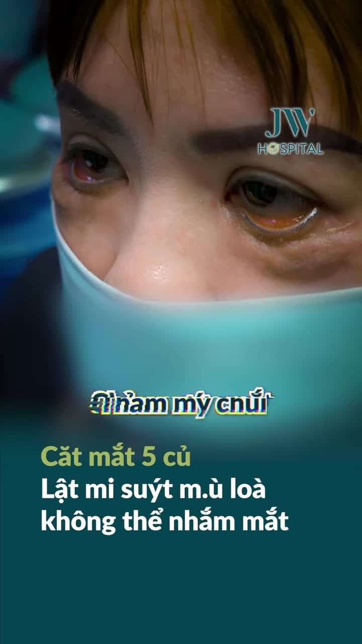 BÁC SĨ TÚ DUNG BÀNG HOÀNG TRƯỚC ĐÔI MẮT LẬT MI SUÝT MÙ CỦA NGƯỜI PHỤ NỮ SAU 3 LẦN CẮT MẮT GIÁ RẺ
