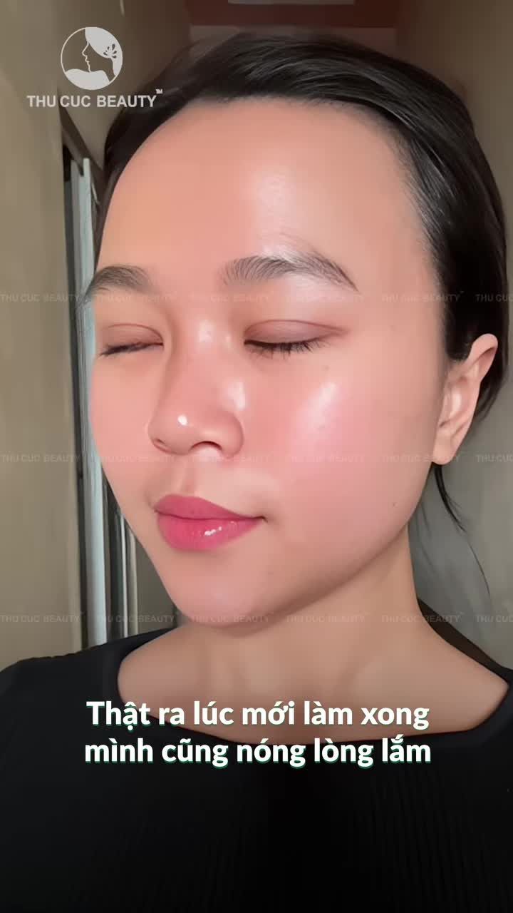 Một ca cắt mí đẹp không chỉ là kết quả, mà còn là cả một quy trình chuẩn y khoa.