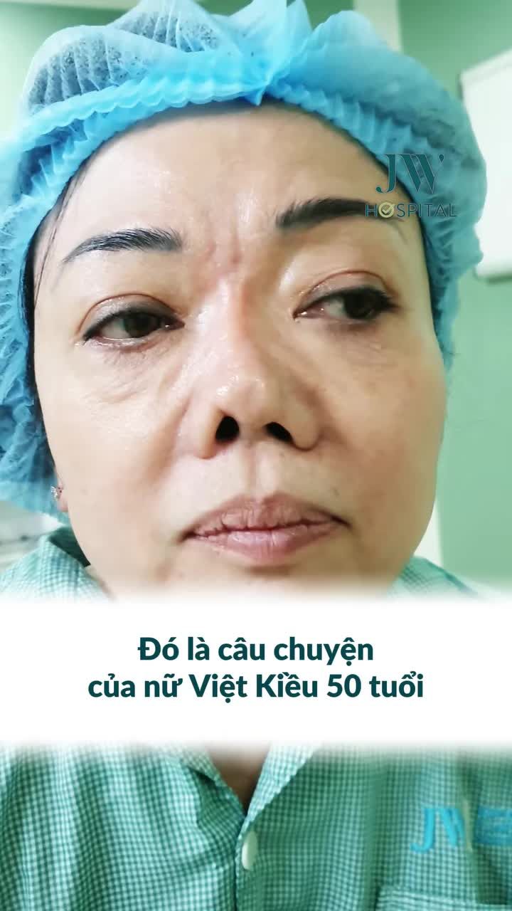 XÓT XA NỮ VIỆT KIỀU MỸ 50 TUỔI: 6 LẦN SỬA MŨI, MẤT GẦN NỬA TỶ ĐỒNG NHẬN LẠI CHIẾC MŨI DỊ DẠNG