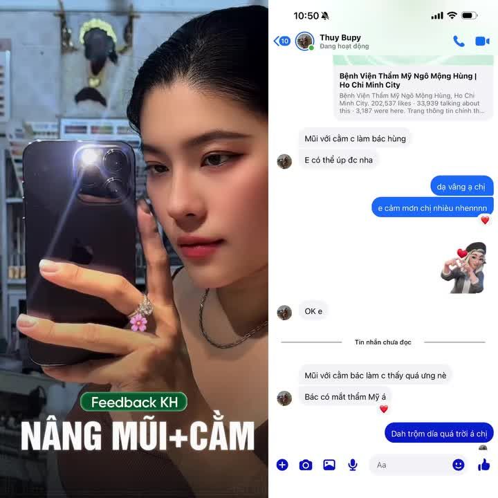 Trộm vía khách yêu sau 1 năm thực hiện combo Mũi + Cằm!