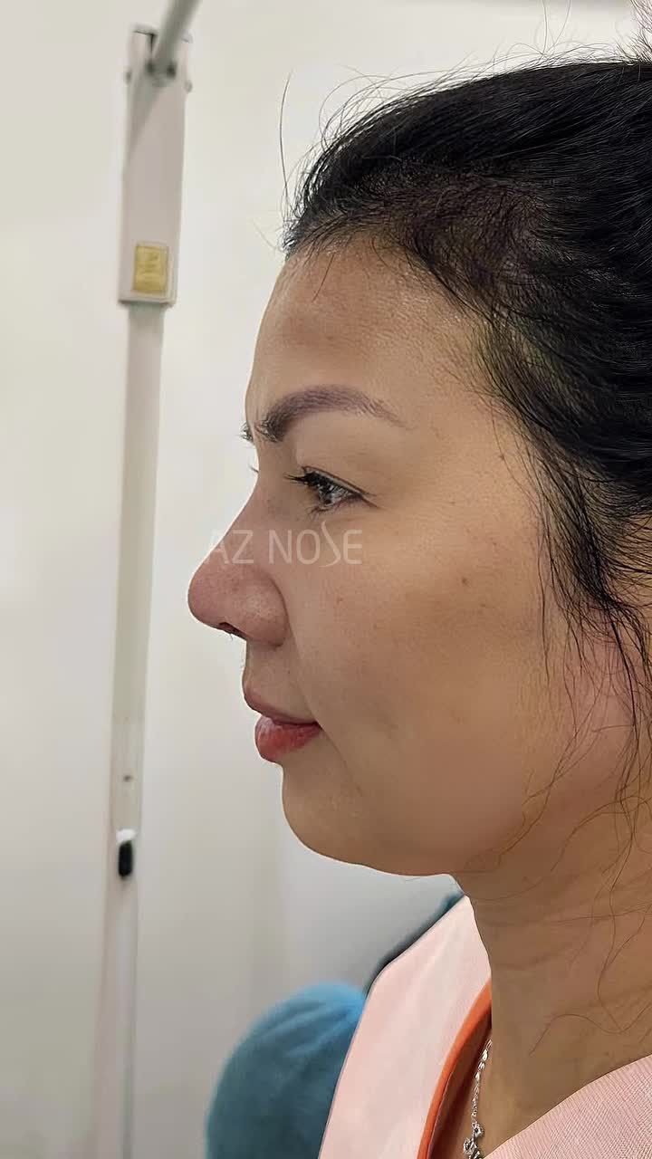 Hành trình thay đổi chỉ gói gọn trong vài giây, nhưng kết quả là cả một quá trình.