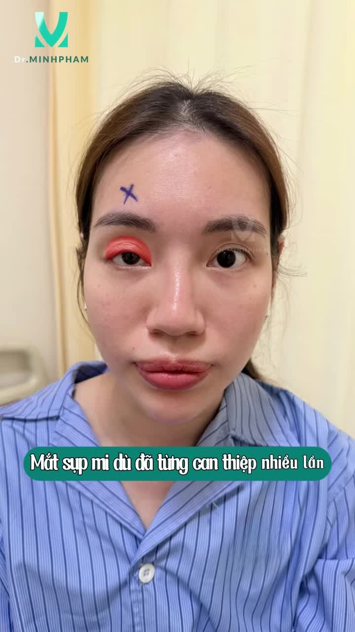 Khi đôi mắt “mệt mỏi” không còn là câu chuyện của riêng bạn