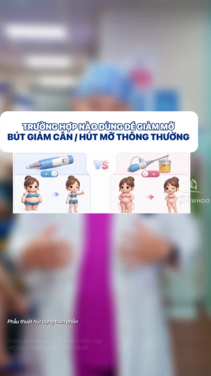 Trường hợp nào nên dùng bút giảm cân? Trường hợp nào nên hút mỡ thông thường?