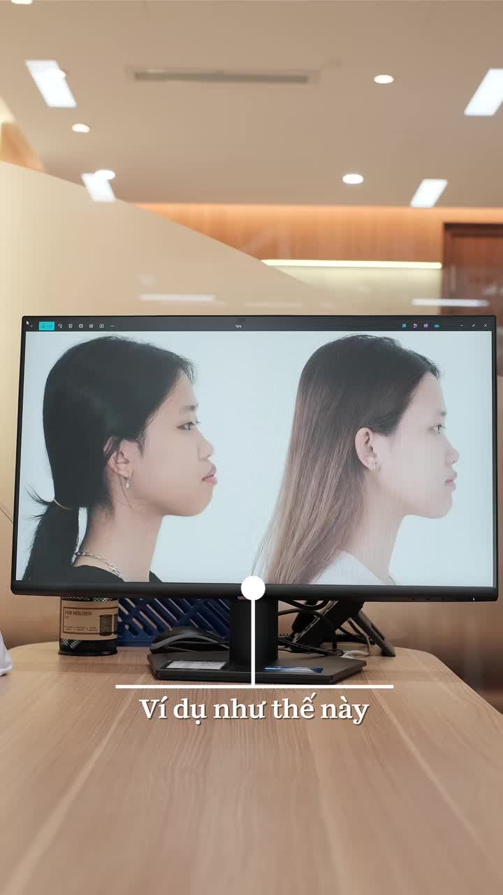 THAY ĐỔI GÓC NGHIÊNG NÓI KHÔNG VỚI DAO KÉO