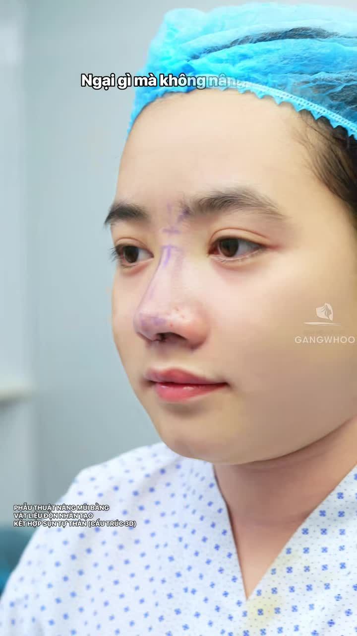 Thanh xuân chỉ có 1, ngại gì mà không nâng mũi để lột xác