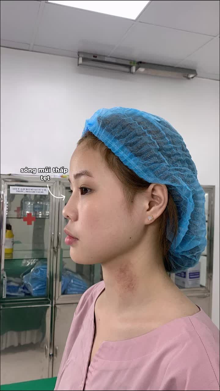Từng cắt mí tại Tấm và cảm thấy hài lòng với sự thay đổi của mình, lần này chị khách H.B tiếp tục quay lại với mong muốn "làm mới" chiếc mũi vốn thấp tẹt của mình.