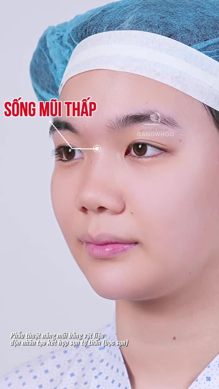 Chiếc mũi 10 điểm không có nhưng