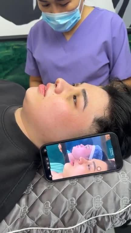 Mũi bọc sụn 10 ngày