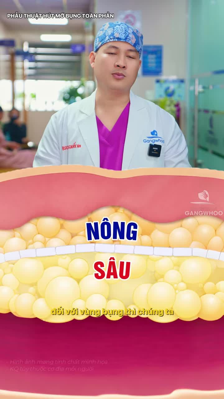 Lý do khiến bụng lồi lõm sau hút mỡ?