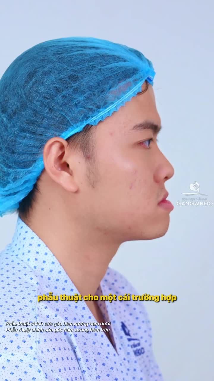 Vì sao hàm móm "lưỡi cày" cần được đánh giá phân tích kỹ trước khi thực hiện?