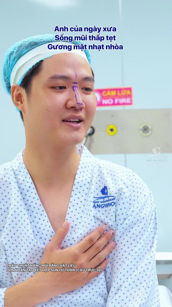Anh của bây giờ đã khác sau 60 phút nâng mũi tại BVTM Gangwhoo
