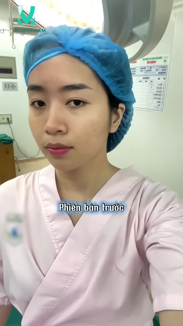 Cập nhật phiên bản mới nhất sau nâng mũi