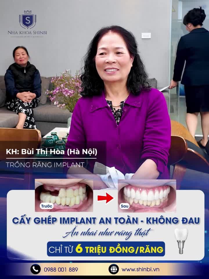 "CHỮA RĂNG LỖI TOÀN HÀM: Đột Phá Công Nghệ 3D Smile Design – Làm Trước, Trả Sau Đầy Nhân Văn"