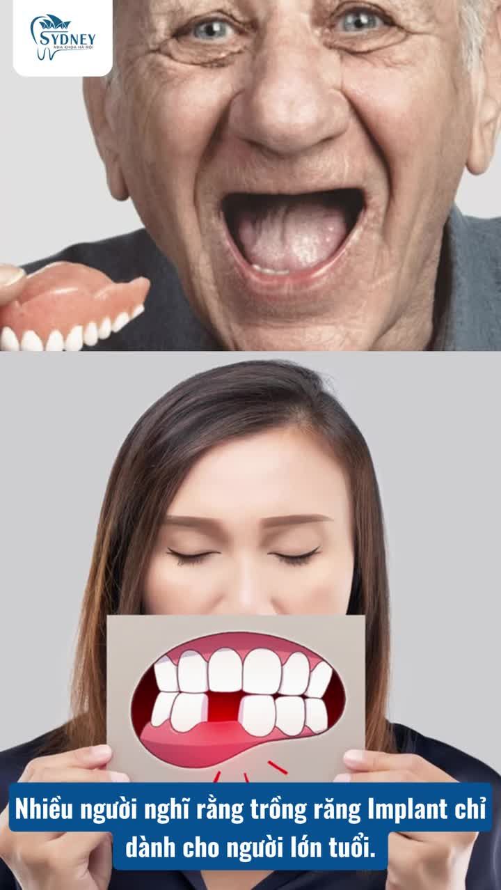 CẤY GHÉP IMPLANT DÀNH CHO ĐỘ TUỔI NÀO?