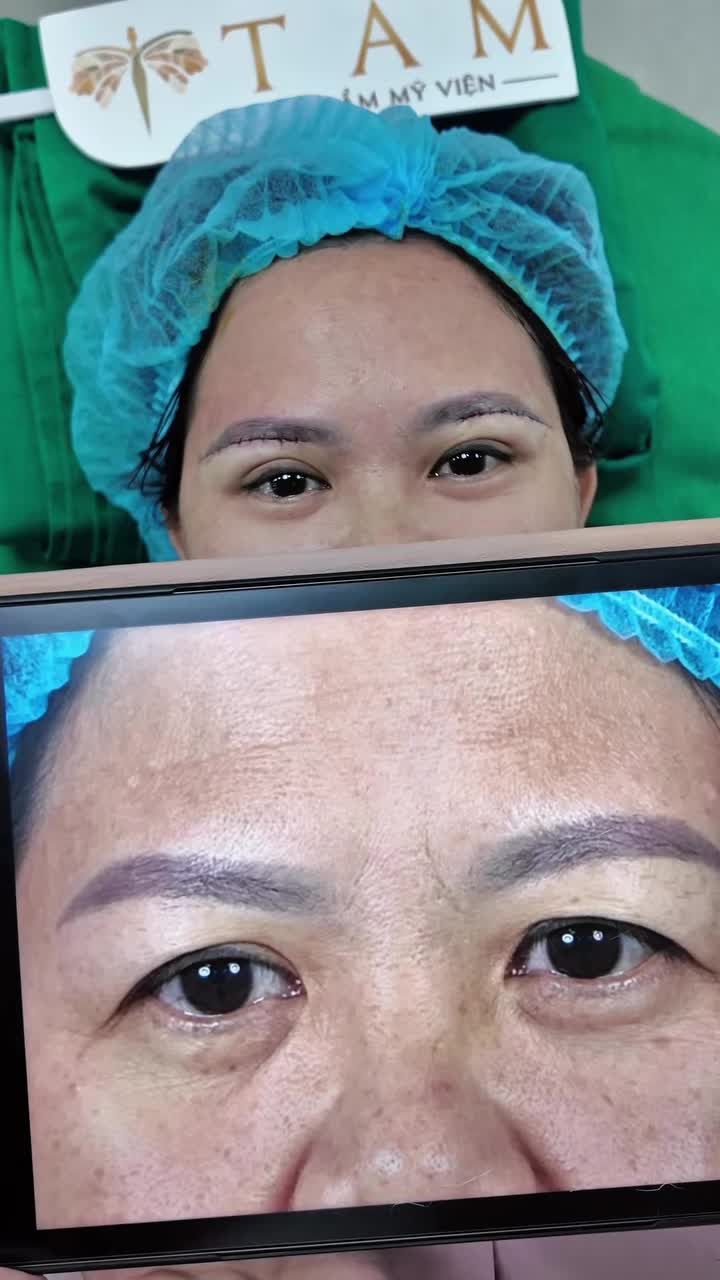 Trẻ hơn 7 tuổi chỉ sau 30p nâng cung mày!