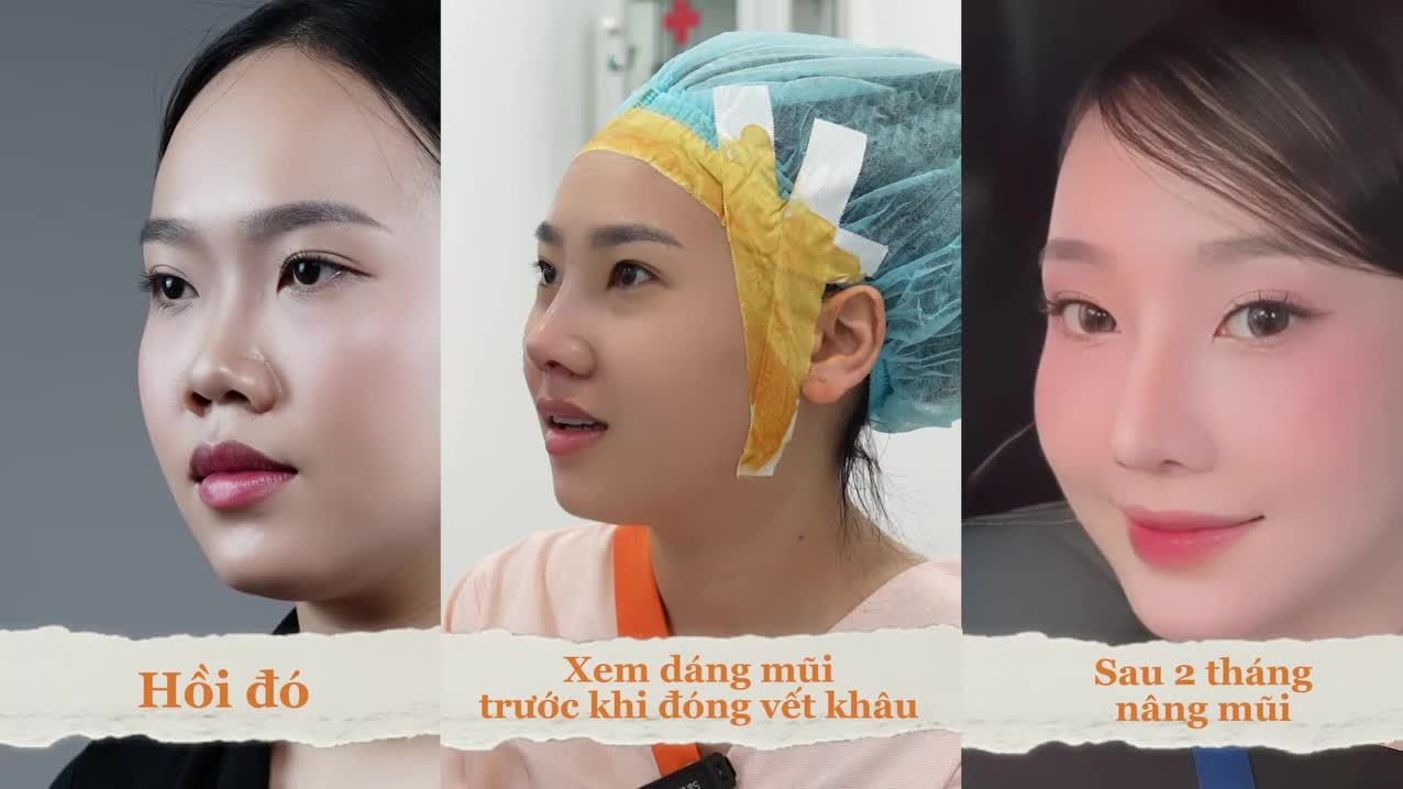 Không cần thay đổi quá nhiều vẫn trở nên xinh hơn.