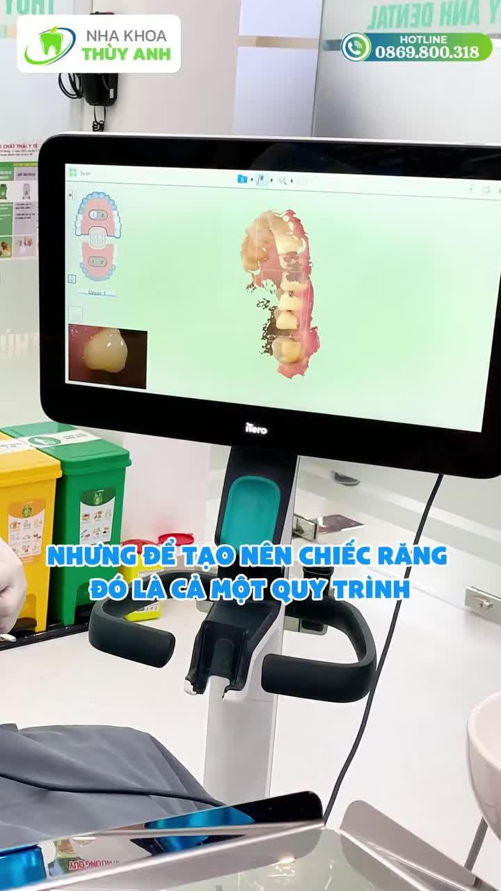 TRƯỚC KHI CÓ MỘT NỤ CƯỜI ĐẸP, ĐÂY LÀ NHỮNG GÌ CÓ THỂ BẠN CHƯA BIẾT!