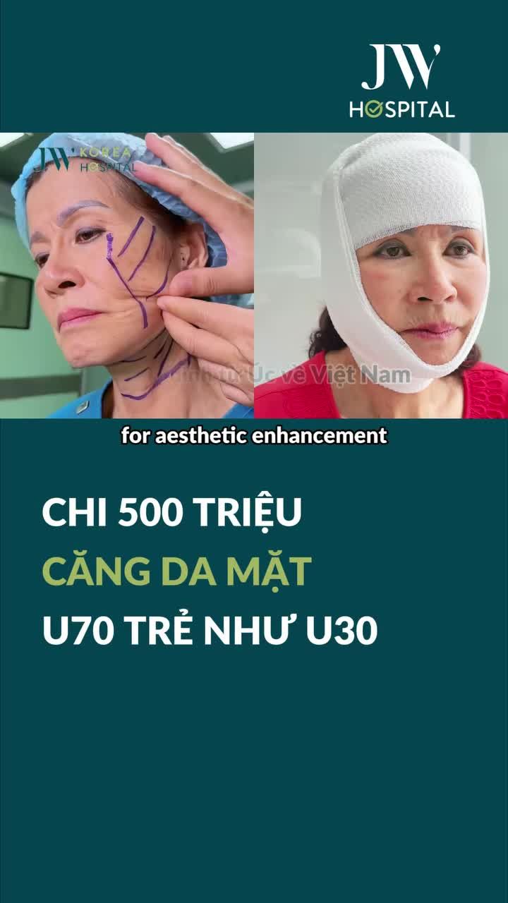 BÁC SĨ TÚ DUNG CĂNG DA MẶT CHO ĐẠI GIA ĐÌNH VIỆT KIỀU ÚC U70 CHI 500 TRIỆU TRẺ NHƯ U30