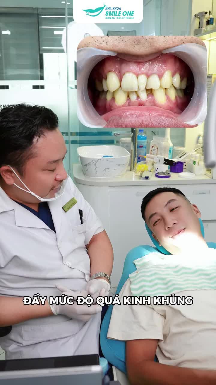 KHÔNG PHẢI RĂNG KHẤP KHỂNH LÀ PHẢI BỌC SỨ