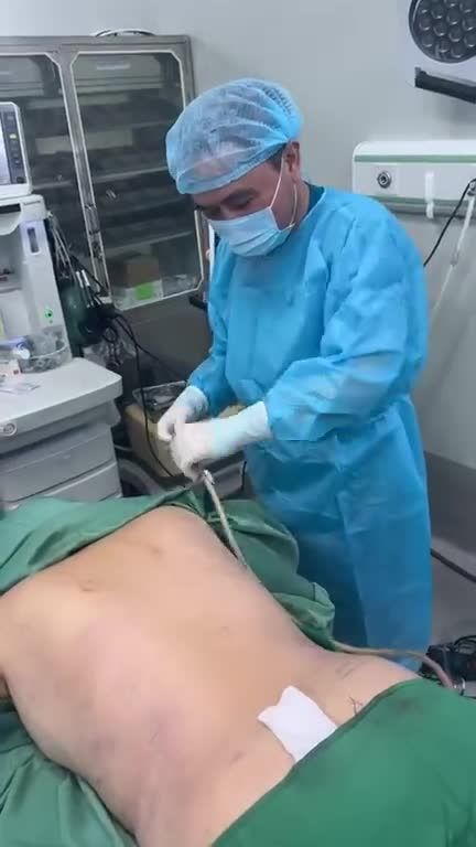 Hút mỡ lưng ko sẹo tuyệt đối !