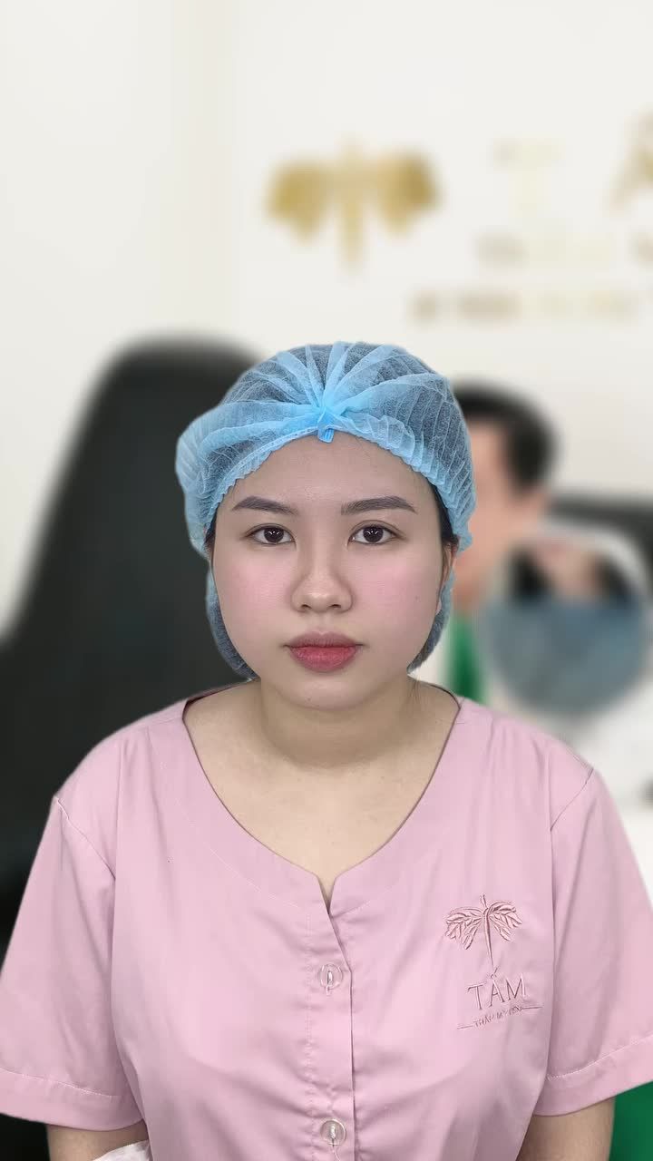 Sau lần cắt mí bị lệch tại spa, chị Phương Thảo quyết định ghé Tấm để làm lại mắt cho cân đối hơn.