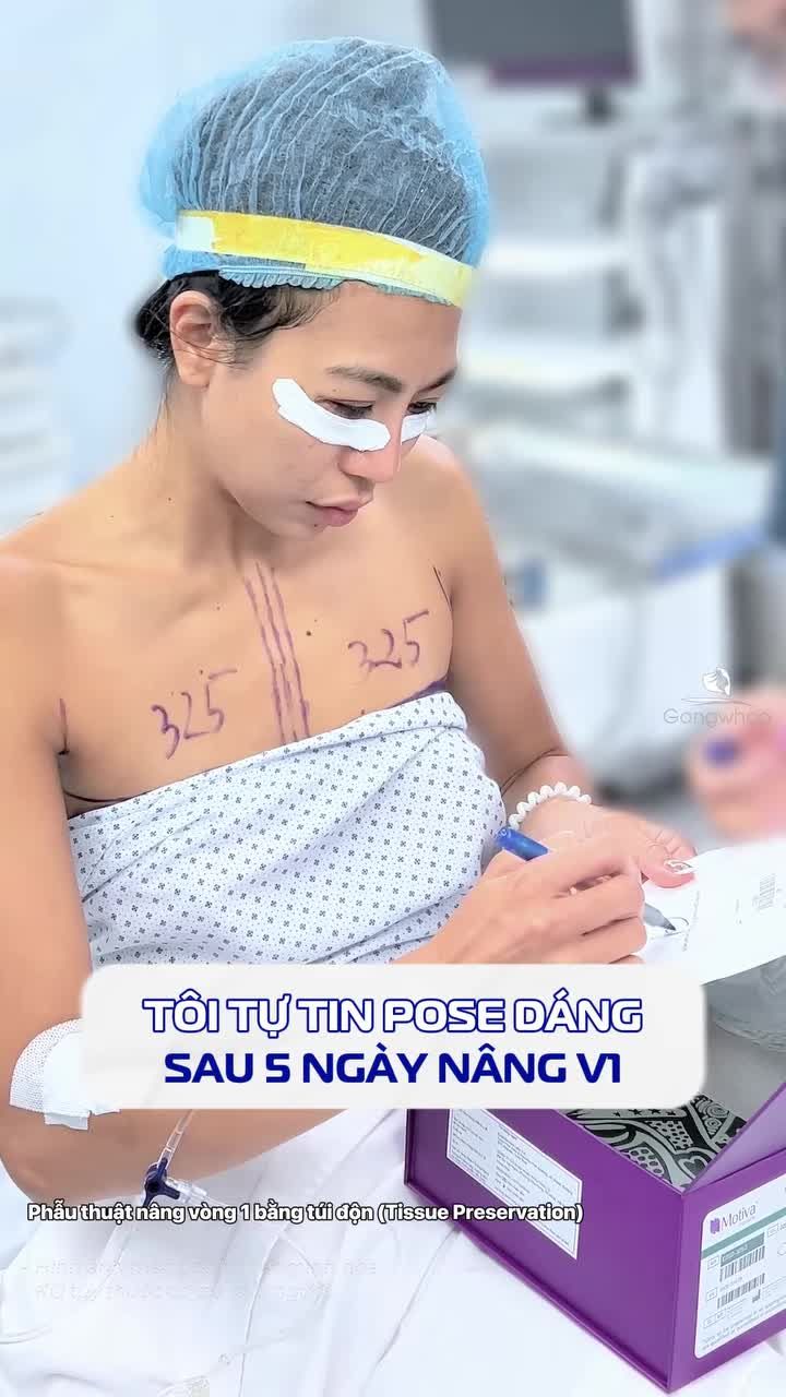 POV: Tôi tự tin pose dáng sau 5 ngày nâng ngực với cặp túi Ergonomix2 xịn sò nhất