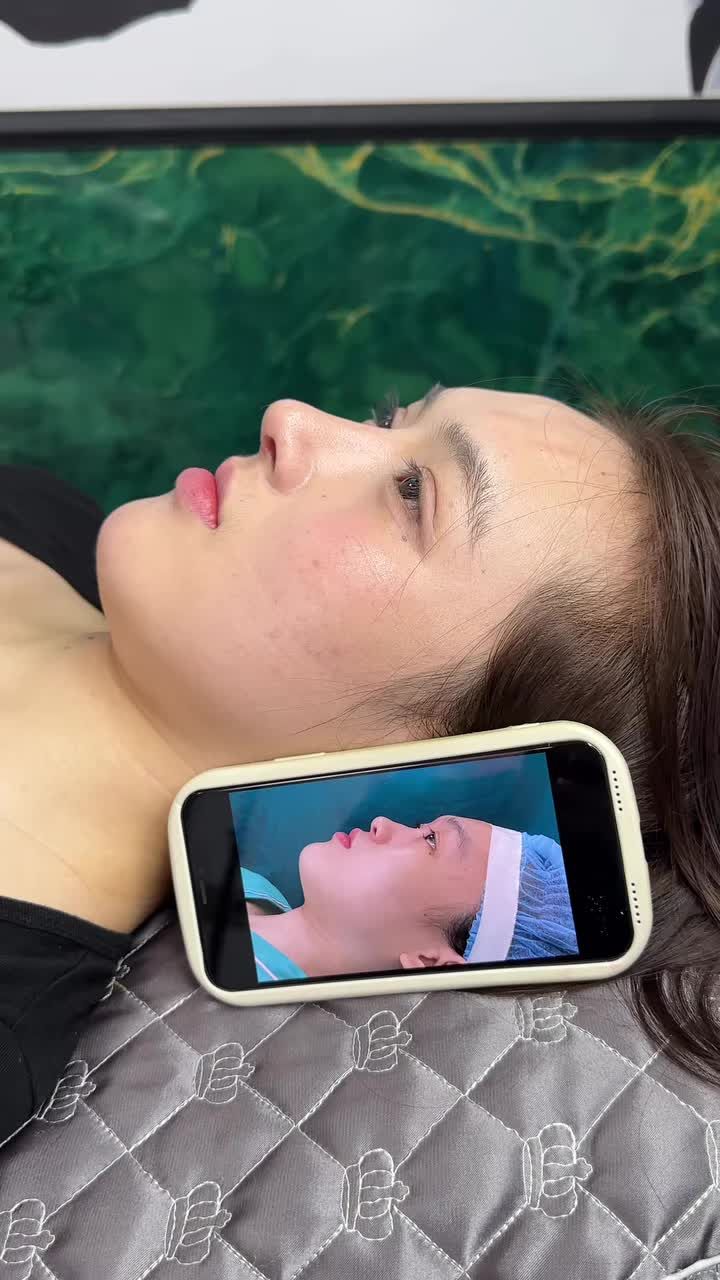 Combo mũi mí 1 tháng