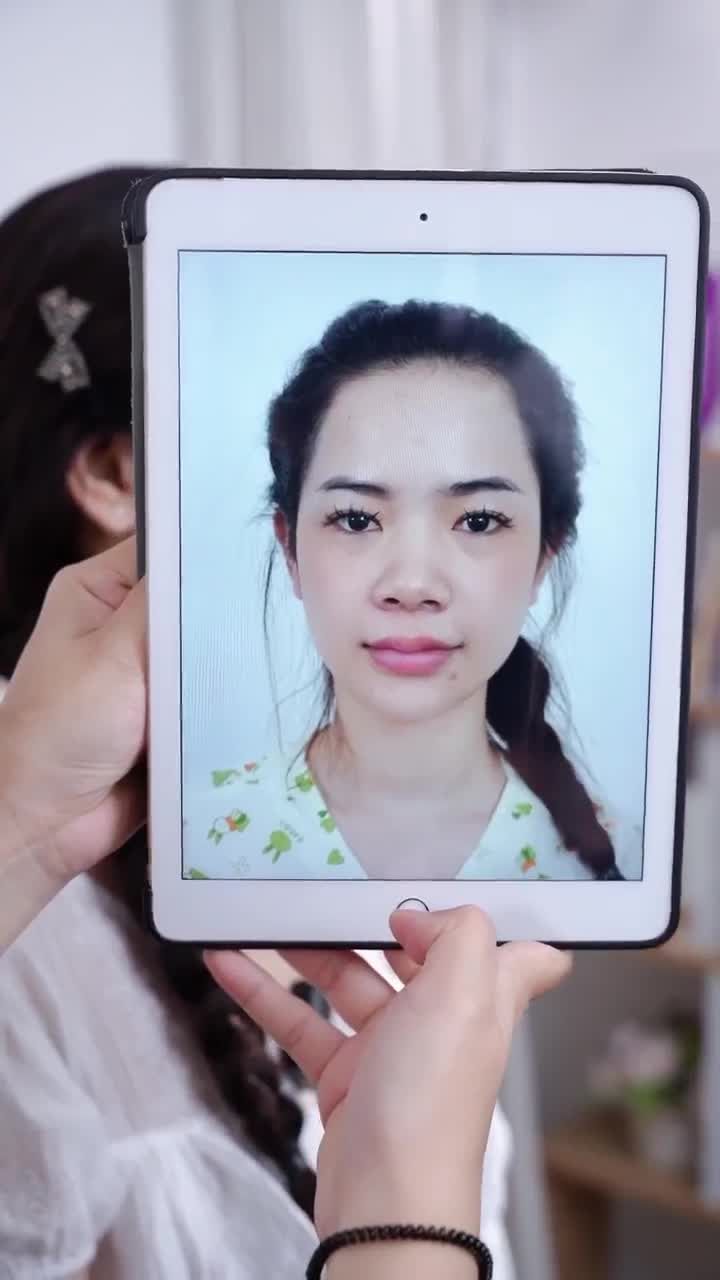 TRẢ KẾT QUẢ SAU HÀNH TRÌNH 10 NGÀY THAY ĐỔI NHAN SẮC CÙNG NÂNG MŨI CẤU TRÚC DR. HOẠT!!!
