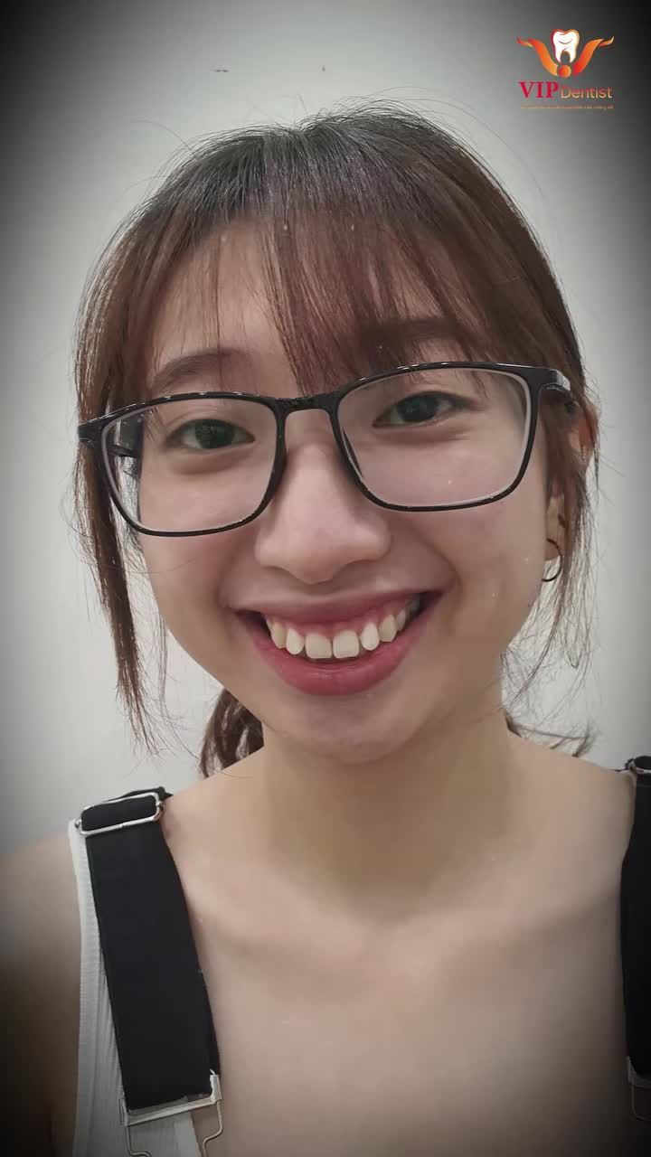 Flex 4 ca niềng của 4 cô gái xinh yêu trong tháng 6 của Vip Dentist!