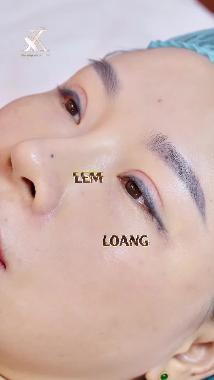 LOẠI BỎ MỰC XĂM MÍ - MẮT ĐẸP HẾT Ý