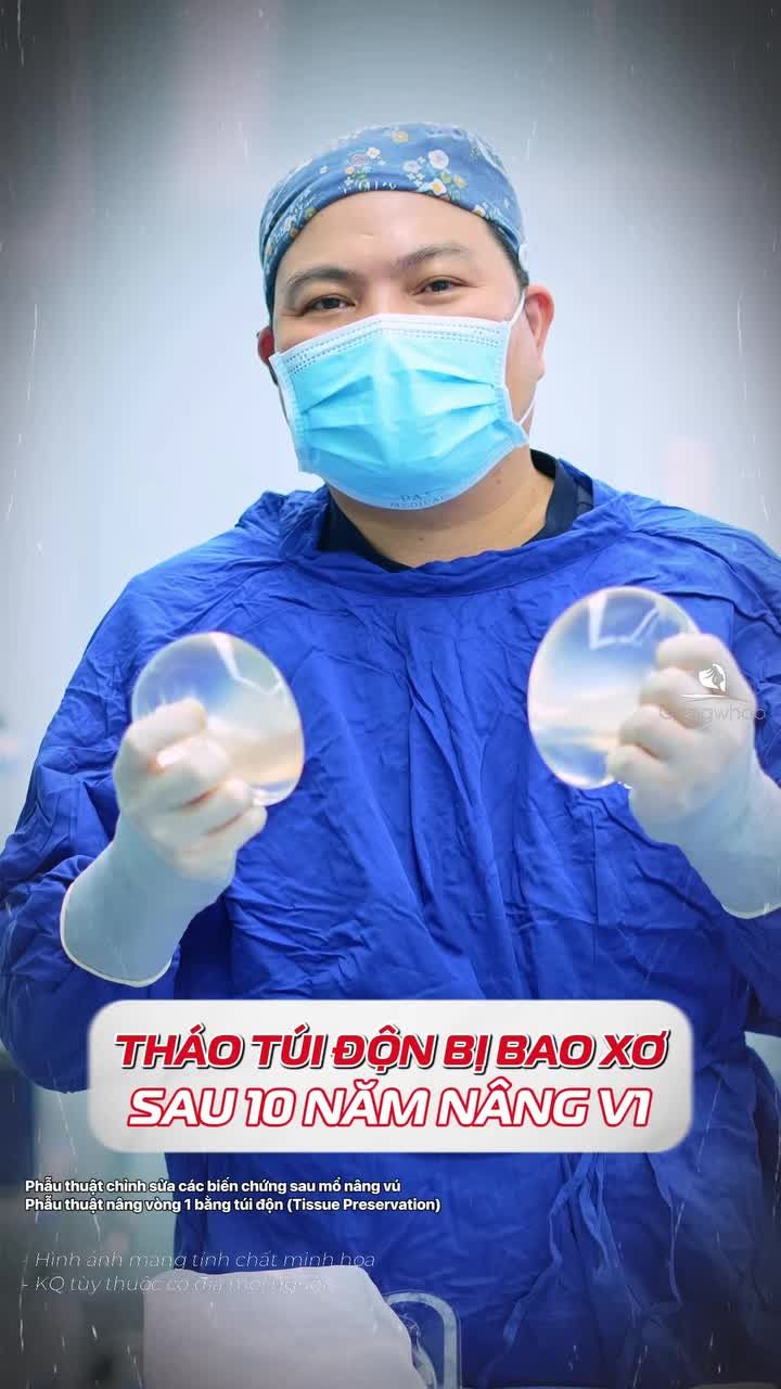 Bác sĩ tháo túi n.gực cũ cho chị khách hàng đã đặt túi cách đây sau 10 năm